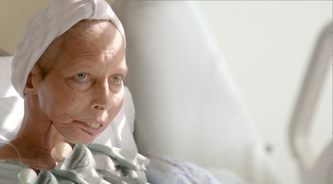 Tobacco patient in hospital bed